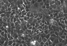 Understanding the Applications of RT-4 Cells in Urological Studies