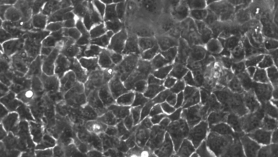 Understanding the Applications of RT-4 Cells in Urological Studies