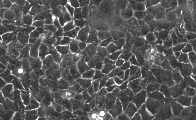 Understanding the Applications of RT-4 Cells in Urological Studies
