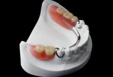 4 Restorative Dentistry Options To Replace Missing Teeth
