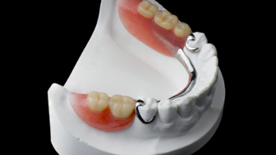 4 Restorative Dentistry Options To Replace Missing Teeth
