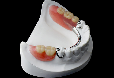 4 Restorative Dentistry Options To Replace Missing Teeth