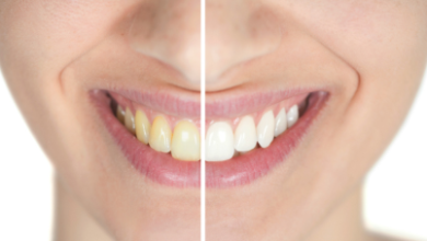 Cosmetic Solutions For Teeth Darkened By Previous Dental Work