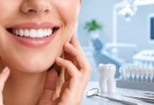The Role Of General Dentistry In Enhancing Smile Makeover Outcomes